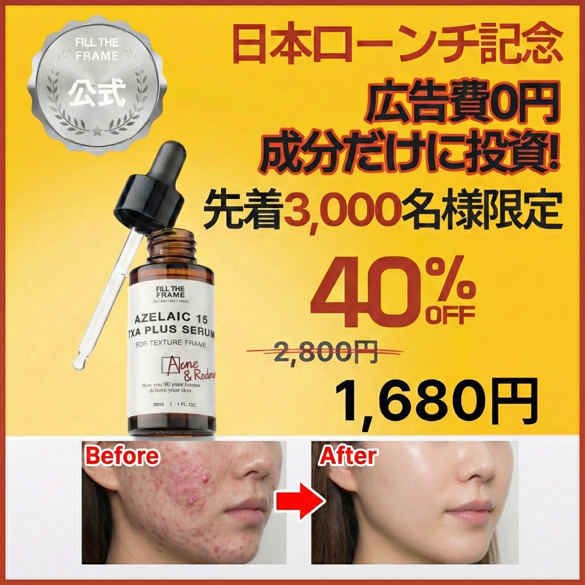 【Qoo10公式】数量限定 アゼライン酸15%+トラネキサム酸4% 美容液 30ml